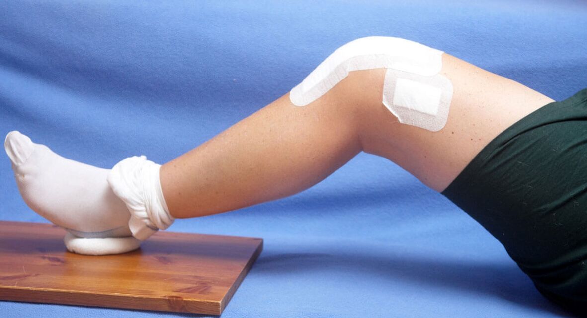 Травма колена как причина остеоартроза